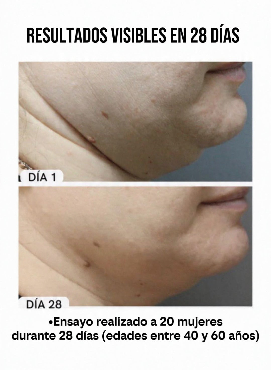 Tratamiento Cuello Rejuvenecido